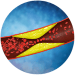 hyperlipidemia-indicator