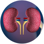 kidney-disease-indicator